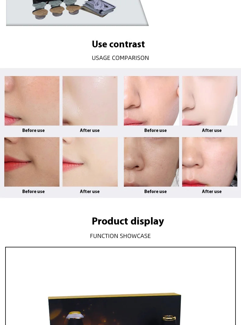 Máquina facial con burbujas de oxigenación Huan
